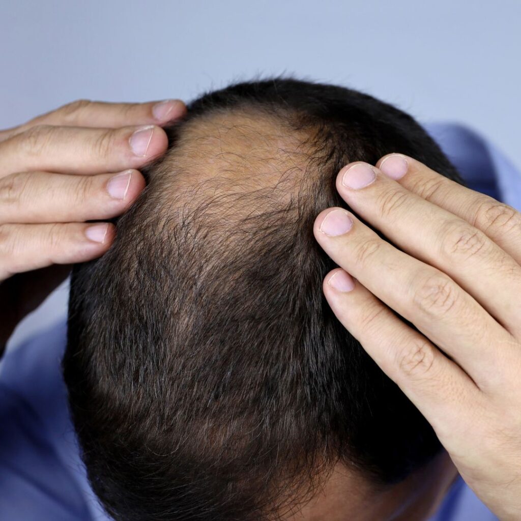 untitled (1080 x 1080 px) (5)